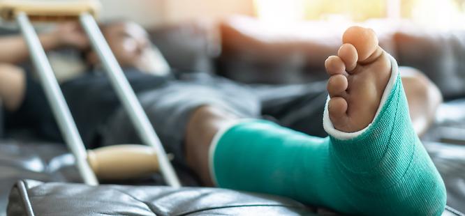 man reclining on couch with green cast on broken foot after going to urgent care