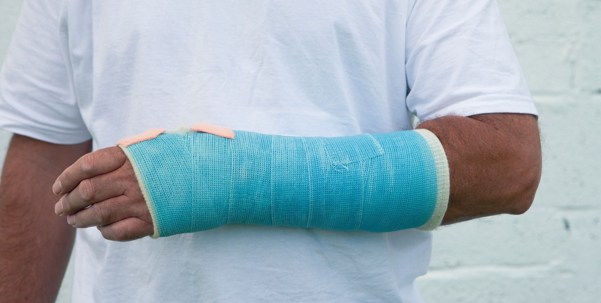 man with broken arm in cast from urgent care